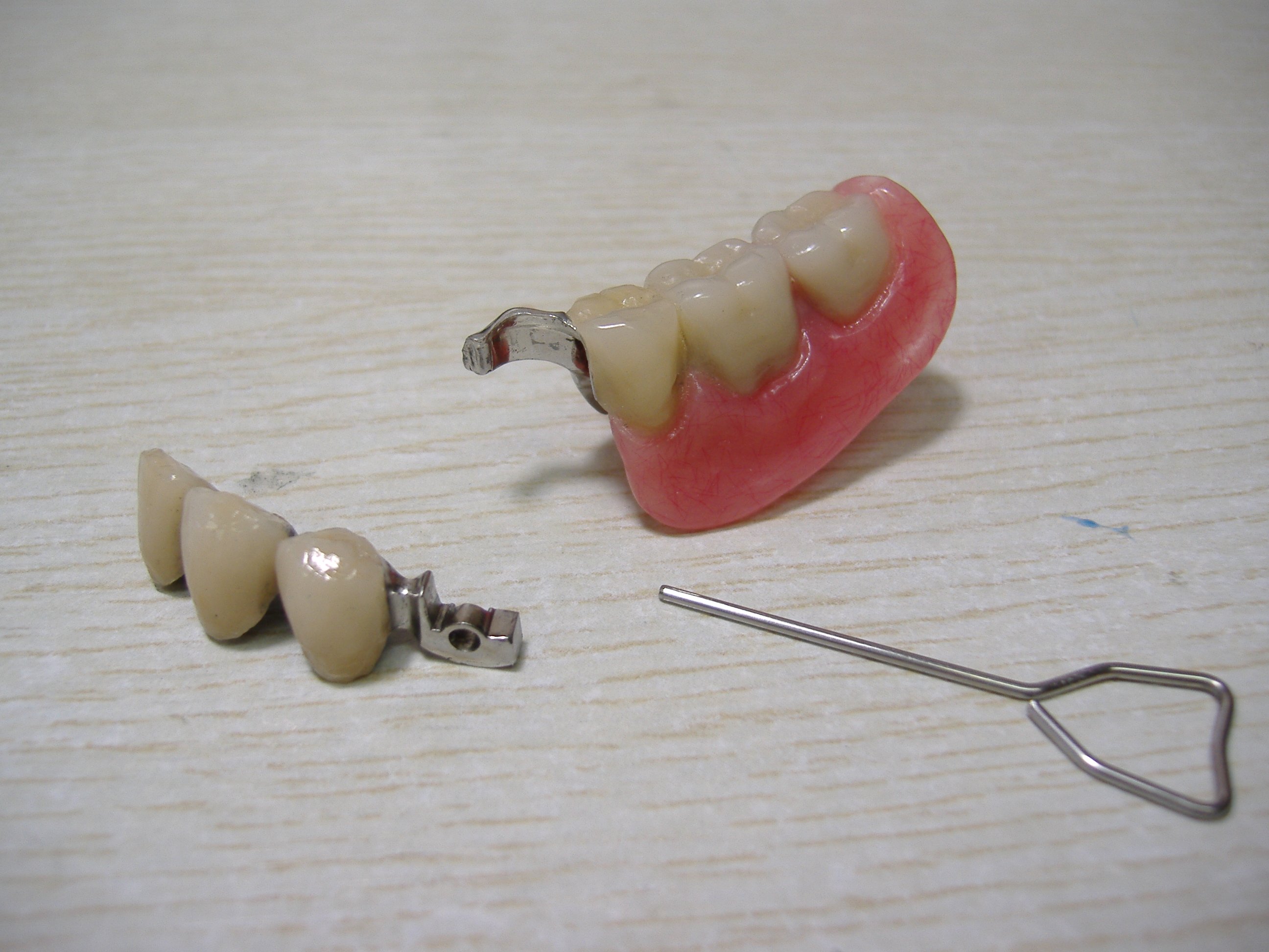 Стоматологическое протезирование отзывы. Бюгельный протез МК-1 односторонний. Бюгельный протез замковый (2 замка Bredent). Бюгельный зубной протез.