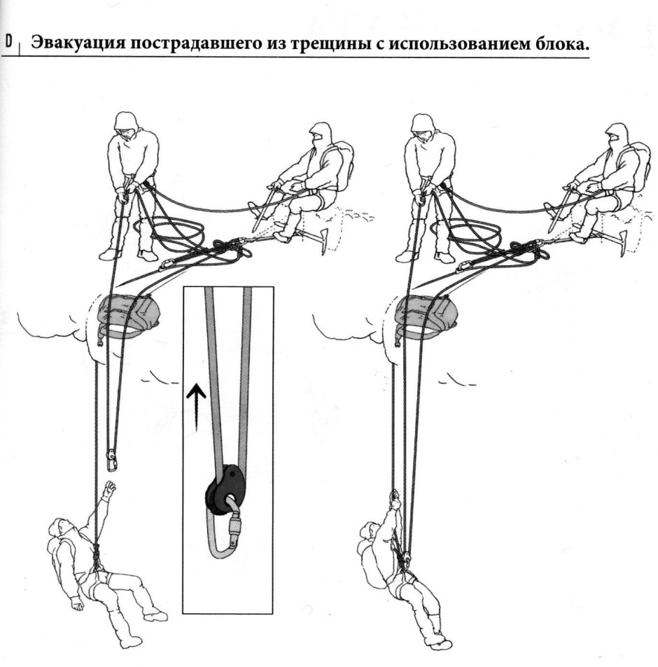 Схемы эвакуации пострадавшего