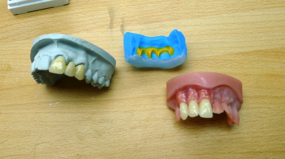 Bio Dentaplast материал