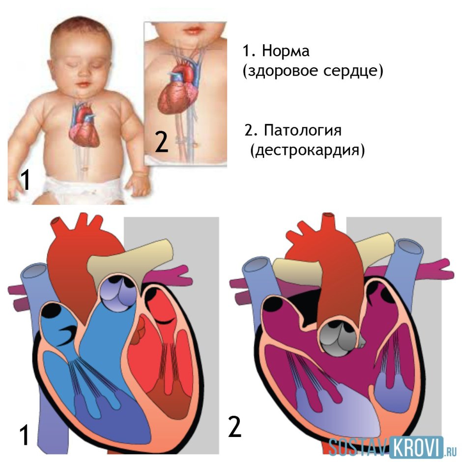 Строение клапанного аппарата сердца