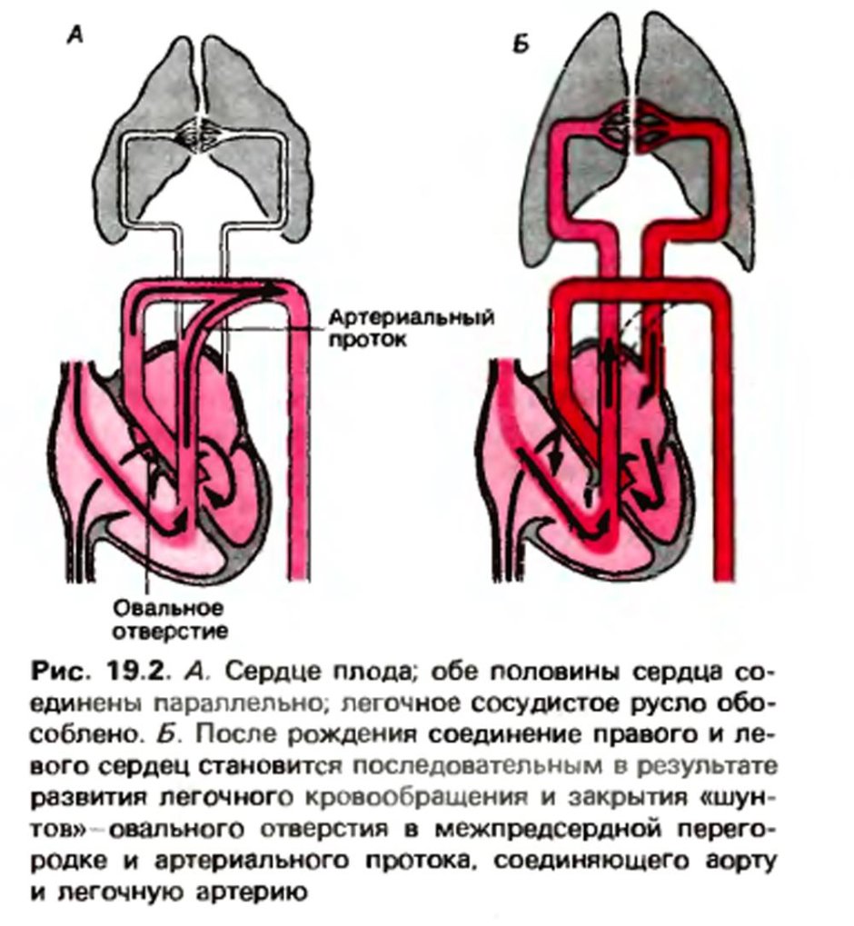 Двухсторонняя пневмония кт 1